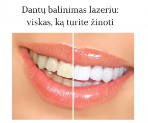 Dantu balinimas